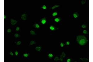 Immunofluorescence staining of MCF-7 cells with ABIN7157075 at 1:100, counter-stained with DAPI. (IRX4 Antikörper  (AA 287-363))