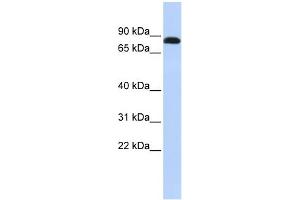 WB Suggested Anti-DSC3 Antibody Titration:  0. (Desmocollin 3 Antikörper  (N-Term))
