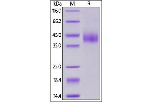 Cynomolgus B7-H6 on  under reducing (R) condition. (B7-H6 Protein (AA 25-259) (His tag))