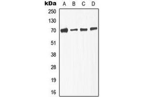 Western blot analysis of TGFBR2 (pS225) expression in A549 (A), NIH3T3L1 (B), KNRK (C), HepG2 (D) whole cell lysates. (TGFBR2 Antikörper  (pSer225))