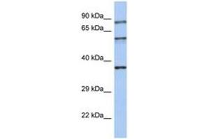 Image no. 1 for anti-Rabphilin 3A (RPH3A) (AA 35-84) antibody (ABIN6744373)