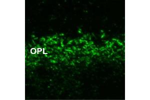 Indirect immunostaining of ribbon synapses in the outer plexiform layer of unfixed mouse retina (dilution 1 : 500).