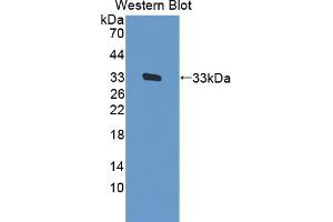 Western blot analysis of the recombinant protein. (FES Antikörper  (AA 509-766))