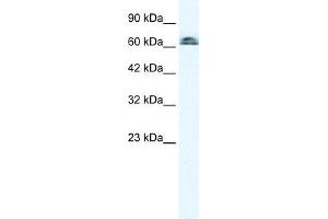 Human K562; WB Suggested Anti-IVNS1ABP Antibody Titration: 0.