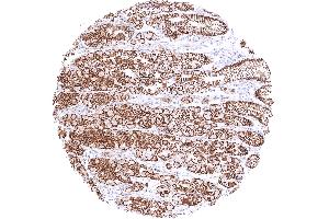 Gastric corpus mucosa with a strong membranous beta catenin staining of all epithelial cells