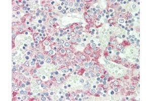 Immunohistochemistry (Paraffin-embedded Sections) (IHC (p)) image for anti-C-Type Lectin Domain Family 1, Member B (CLEC1B) (N-Term) antibody (ABIN2739992)