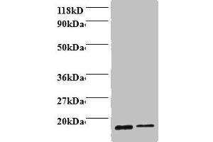 Western blot All lanes: Profilin-1 antibody at 2 μg/mL Lane 1: EC109 whole cell lysate Lane 2: 293T whole cell lysate Secondary Goat polyclonal to rabbit IgG at 1/15000 dilution Predicted band size: 16 kDa Observed band size: 16 kDa (PFN1 Antikörper  (AA 2-140))