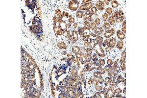 IHC analysis of ECE1 using anti-ECE1 antibody (ABIN5518828). (ECE1 Antikörper  (AA 18-233))