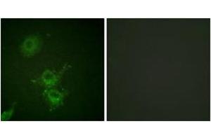 Immunofluorescence analysis of HuvEc cells, using EGFR (Phospho-Thr693) Antibody. (EGFR Antikörper  (pThr693))