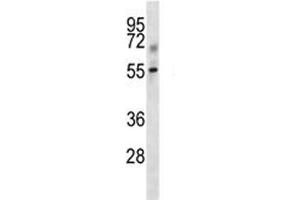 Tgfbr1 antibody western blot analysis in mouse kidney tissue lysate. (TGFBR1 Antikörper  (AA 141-169))