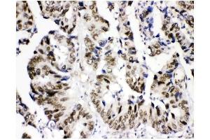 IHC analysis of KDM5B using anti-KDM5B antibody (ABIN4886648). (KDM5B Antikörper  (Middle Region))