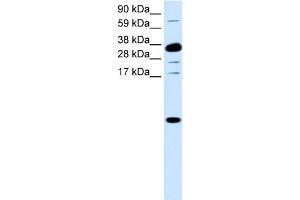 WB Suggested Anti-CXCL1 Antibody Titration:  0. (CXCL1 Antikörper  (Middle Region))