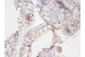 Immunohistochemistry of paraffin-embedded human testis tissue using ABIN7141195 at dilution of 1:100 (Butyrylcholinesterase Antikörper  (AA 1-141))