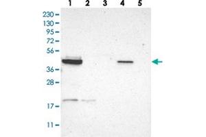 Western blot analysis of Lane 1: RT-4, Lane 2: U-251 MG, Lane 3: Human Plasma, Lane 4: Liver, Lane 5: Tonsil with GRAMD3 polyclonal antibody  at 1:250-1:500 dilution. (GRAMD3 Antikörper)