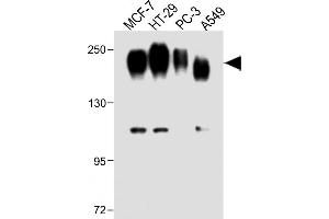 All lanes : Anti-CEA Antibody (Center) at 1:1000 dilution Lane 1: MCF-7 whole cell lysate Lane 2: HT-29 whole cell lysate Lane 3: PC-3 whole cell lysate Lane 4: A549 whole cell lysate Lysates/proteins at 20 μg per lane. (CEA Antikörper  (AA 400-429))