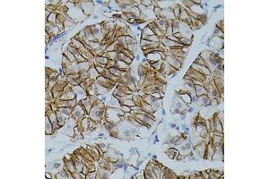 Immunohistochemistry of paraffin-embedded human stomach using CLDN3 antibody (ABIN3017039, ABIN3017040, ABIN3017041, ABIN1679261 and ABIN6219930) (40x lens). (Claudin 3 Antikörper)