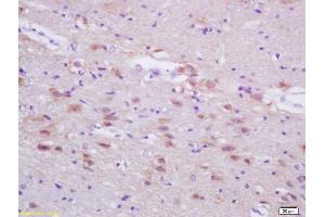 Formalin-fixed and paraffin embedded rat brain labeled with Anti-ASN/Fatty Acid Synthase 1 Polyclonal Antibody, Unconjugated (ABIN687382) at 1:200, followed by conjugation to the secondary antibody and DAB staining (Fatty Acid Synthase Antikörper  (AA 651-750))