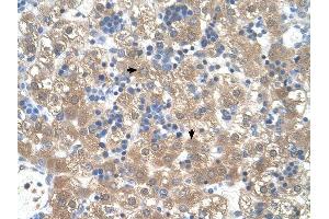 PEX3 antibody was used for immunohistochemistry at a concentration of 4-8 ug/ml to stain Hepatocytes (arrows) in Human Liver. (PEX3 Antikörper  (N-Term))