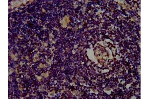 IHC image of ABIN7153444 diluted at 1:400 and staining in paraffin-embedded human lymph node tissue performed on a Leica BondTM system. (Galectin 10 Antikörper  (AA 2-142))