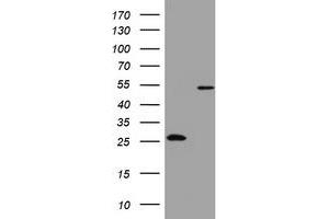 Image no. 4 for anti-3-Oxoacyl-ACP Synthase, Mitochondrial (OXSM) (AA 78-343) antibody (ABIN1491674) (OXSM Antikörper  (AA 78-343))