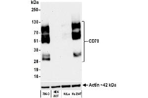 Western Blotting (WB) image for anti-CD70 Molecule (CD70) (AA 50-193) antibody (ABIN7449156) (Rekombinanter CD70 Antikörper  (AA 50-193))