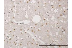 Image no. 1 for anti-TP53 Regulating Kinase (TP53RK) (AA 154-253) antibody (ABIN466264) (TP53RK Antikörper  (AA 154-253))