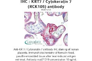 Image no. 1 for anti-Keratin 7 (KRT7) antibody (ABIN1724125) (Cytokeratin 7 Antikörper)