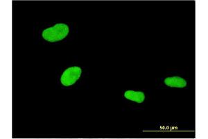 Immunofluorescence of monoclonal antibody to ZKSCAN4 on HeLa cell. (ZKSCAN4 Antikörper  (AA 1-545))