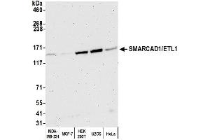 Western Blotting (WB) image for anti-SWI/SNF-Related, Matrix-Associated Actin-Dependent Regulator of Chromatin, Subfamily A, Containing DEAD/H Box 1 (SMARCAD1) (AA 976-1026) antibody (ABIN7450747)