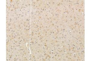 ABIN6265291 and ABIN6279800 at 1/100 staining rat brain tissue by IHC-P.