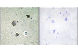 Immunohistochemistry analysis of paraffin-embedded human brain tissue using CDK5 (epitope around residue 15) antibody. (CDK5 Antikörper  (Tyr15))
