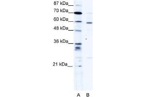 Human HepG2; WB Suggested Anti-PDLIM5 Antibody Titration: 1. (PDLIM5 Antikörper  (Middle Region))