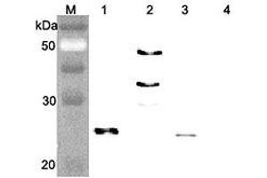 Western blot analysis of human FGF21 using anti-FGF-21 (human), pAb  at 1:4,000 dilution. (FGF21 Antikörper)