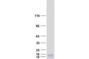 Western Blotting (WB) image for Apoptosis-Inducing, TAF9-Like Domain 1 (APITD1) (Transcript Variant B) protein (Myc-DYKDDDDK Tag) (ABIN2716304)