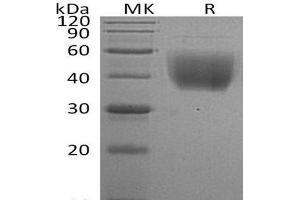 Western Blotting (WB) image for CD80 (CD80) protein (His tag) (ABIN7321262) (CD80 Protein (CD80) (His tag))
