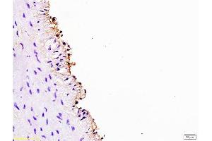 Formalin-fixed and paraffin embedded rabbit carotid artery labeled Anti-Cyclin D3 Polyclonal Antibody, Unconjugated  at 1:200, followed by conjugation to the secondary antibody and DAB staining (Cyclin D3 Antikörper  (AA 121-220))