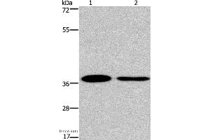 Western blot analysis of 293T and A549 cell, using SNAI1 Polyclonal Antibody at dilution of 1:200 (SNAIL Antikörper)