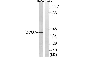Western blot analysis of extracts from HepG2 cells, using CACNG7 antibody. (CACNG7 Antikörper  (Internal Region))