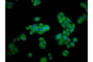 Immunofluorescence staining of PC-3 cells with ABIN7145507 at 1:100, counter-stained with DAPI.