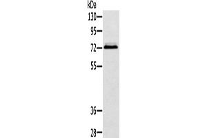 Western Blotting (WB) image for anti-Synovial Sarcoma, X Breakpoint 2 Interacting Protein (SSX2IP) antibody (ABIN2424211) (SSX2IP Antikörper)
