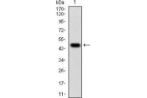 Western blot analysis using WT1 mAb against human WT1 (AA: 314-479) recombinant protein.