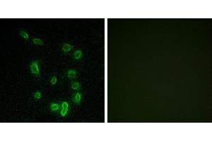 P-peptide - +Immunofluorescence analysis of HepG2 cells, using DARPP-32 (Phospho-Thr34) antibody. (DARPP32 Antikörper  (pThr34))