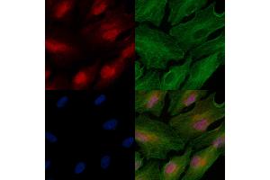 Phospho-MeCP2 (Ser423) Antibody staining A549 cells(heat shock treatment) by IF/ICC. (MECP2 Antikörper  (pSer423))