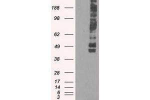Image no. 4 for anti-Solute Carrier Family 2 (Facilitated Glucose/fructose Transporter), Member 5 (SLC2A5) antibody (ABIN1498478) (SLC2A5 Antikörper)