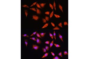 Immunofluorescence analysis of L929 cells using HSP antibody (ABIN6128040, ABIN6142040, ABIN6142041 and ABIN6223893) at dilution of 1:100. (HSPA2 Antikörper  (AA 400-639))