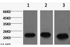 Western Blot analysis of 1) MCF7, 2) Rat kidney, 3) Mouse brain using PRDX1 Monoclonal Antibody at dilution of 1:2000. (Peroxiredoxin 1 Antikörper)