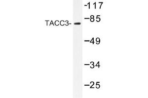 Image no. 1 for anti-Transforming, Acidic Coiled-Coil Containing Protein 3 (TACC3) antibody (ABIN317622) (TACC3 Antikörper)