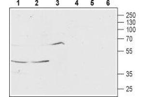 Western blot analysis of rat brain (lanes 1 and 4), mouse brain (lanes 2 and 5) and human SH-SY5Y (lanes 3 and 6) lysates: - 1-3. (MCHR1 Antikörper  (Extracellular, N-Term))