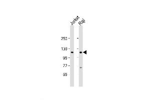 Western Blot at 1:2000 dilution Lane 1: Jurkat whole cell lysate Lane 2: Raji whole cell lysate Lysates/proteins at 20 ug per lane. (WHSC1 Antikörper  (C-Term))