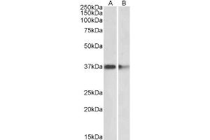 ABIN5539476 (2µg/ml) staining of Mouse (A) and Rat (B) Brain lysates (35µg protein in RIPA buffer). (PRMT2 Antikörper  (Internal Region))